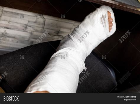 Leg Bandage Fixed Image And Photo Free Trial Bigstock