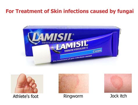 Lamisil Cream 1 Terbinafine Treatment Fungal Skin Infection Athletes