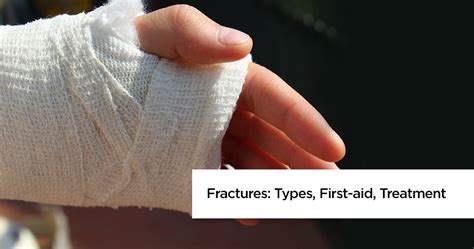 Types Of Fractures Broken Bone First Aid For Fractures Treatment