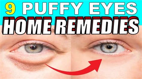 9 Quick Home Remedies To Treat Puffy Eyes And Bags Naturally Causes Of