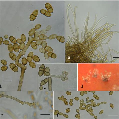 Cladosporium Echinulatum A Conidiophores B Small Conidia And