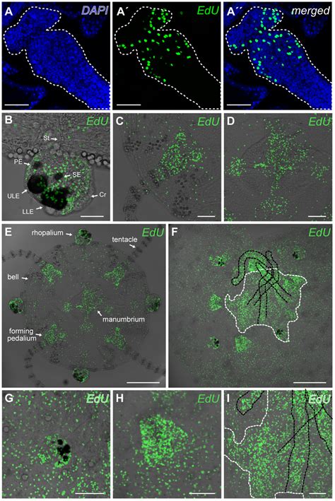 Proliferation Zones In Juvenile Medusae Of Tripedalia Cystophora And