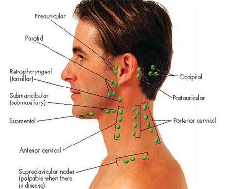 This nodal level can be subdivided into 1a (submental) and 1b (submandibular). Lymph nodes or lymph organs are critical in light of the ...