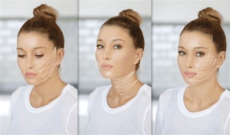 Discover How Lifting Threads Improve Your Double Chin Swiss Beauty And Care