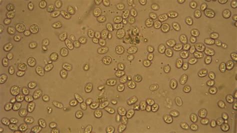 Animal cell under microscope 40x. Pics of Yeast under my new microscope | HomeBrewTalk.com ...