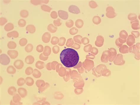 Red Blood Cell Maturation A Laboratory Guide To Clinical Hematology