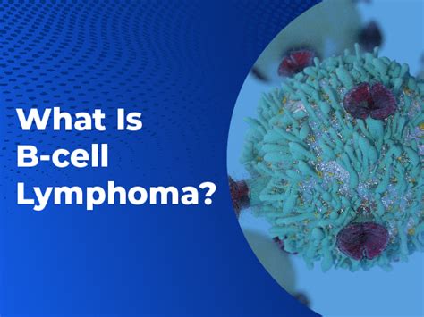 What Is B Cell Lymphoma