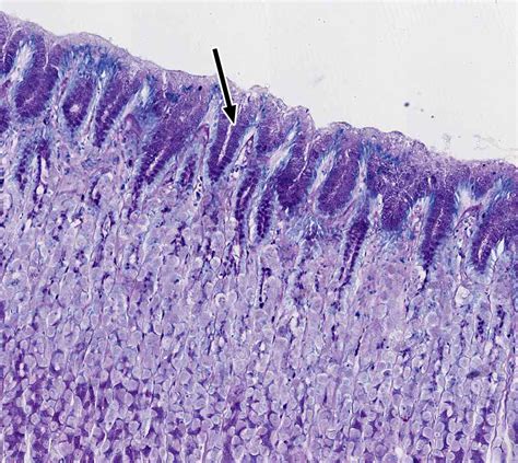 Pharynx Esophagus And Stomach Histology