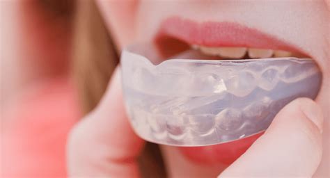 the many benefits of mouth guards smile design manhattan cosmetic dentistry