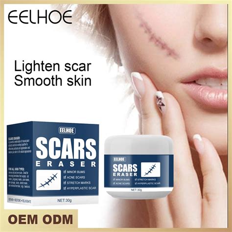 Eelhoe Scar Removal Cream Acne Scars Gel Stretch Marks Surgical Scar