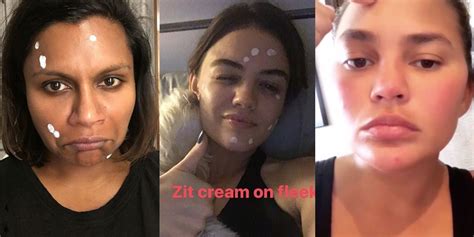 34 Celebrities Talk About Their Struggle With Acne