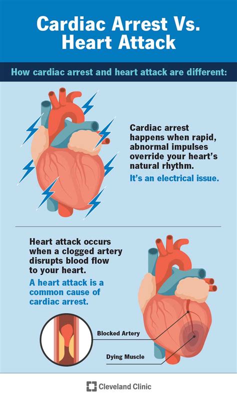 Cardiac Arrest Symptoms Causes And Treatment