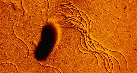 Pseudomonas aeruginosa in healthcare settings. Two stationary kinds of bacteria can move when mixed ...