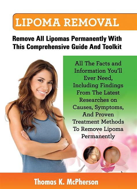 Lipoma Removal Guide Get All The Facts And Information On Lipoma