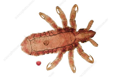 Head Louse Stock Image Z2650138 Science Photo Library