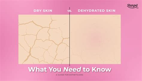 Working With Dry Vs Dehydrated Skin A Guide For Professionals