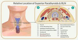 Parathyroid Anatomy Image 10 Hyperparathyroidism Surgery Dr Babak