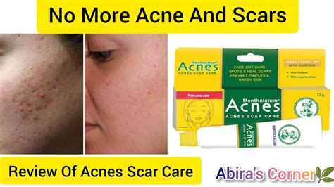 Review Of Acnes Scar Care Gel How To Use Medicated Acne Scar Treatment Abira S Corner