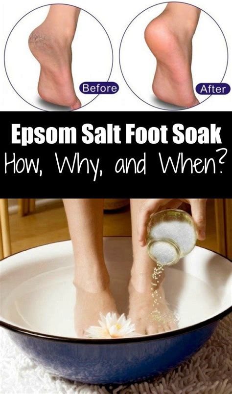 Although it is referred to as salt, it does not contain sodium and, despite sharing similar physical characteristics, has different properties from table salt. Epsom Salt Foot Soak: How, Why, and When? | Epsom salt ...