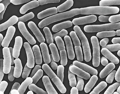 Cause of typhi salmonellosis (typhi fever, paratyphi a, b and c), salmonella enterica serotype typhi or paratyphi a, b and c include salmonella to the family of enterobacteriaceae. Salmonella Typhi Photograph by Dennis Kunkel Microscopy ...