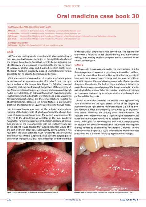 Pdf Oral Medicine Case Book 30 Oral Squamous Carcinoma