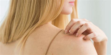 Psoriasis Vs Eczema How To Tell The Difference Self