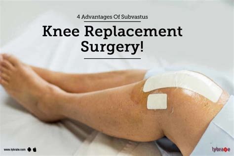 Advantages Of Subvastus Knee Replacement Surgery By Dr Kunal Makhija Lybrate