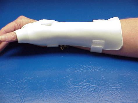 Splints Long Opponens Splint Stabilizes The Thumb In Abduction