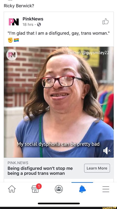 Ricky Berwick I M Glad That I Am A Disfigured Gay Trans Woman Being Disfigured Won T Stop