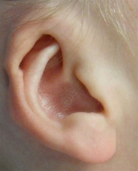Baby Ear Molding Expert In Your Home Within 48 Hours Dr Onganlar