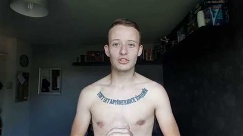 Ftm Update Stage Phalloplasty Days Post Op Youtube