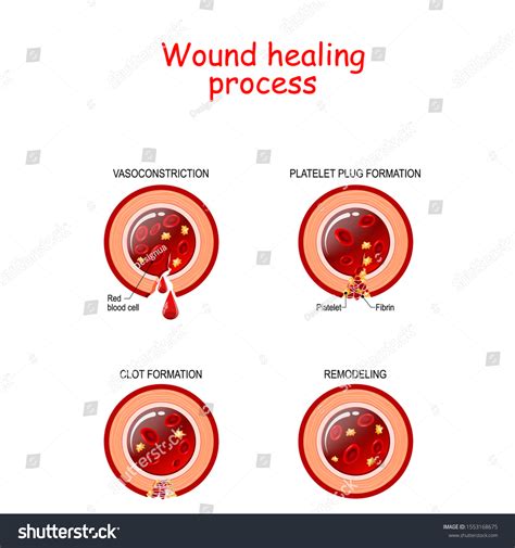 Phases Wound Healing Process Cross Section Stock Vector Royalty Free