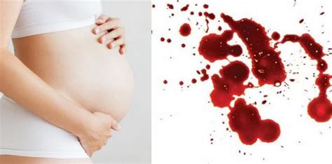 Darah yang keluar setelah melahirkan dengan selang waktu 15 hari atau lebih, disebut darah haidl bila memenuhi syarat haidl. 15 Tanda Tanda Hamil dari Awal Kehamilan hingga Akhir ...