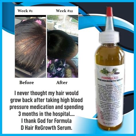 Let's see how it benefits hair and skin. Extra Strength Formula D Hair Growth Oil With Amla Coconut ...