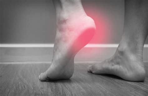 Are You Suffering From Plantar Fasciitis