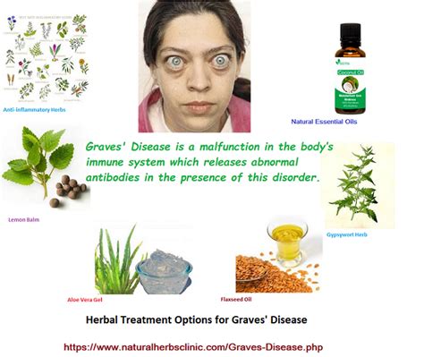 Graves Disease Herbal Treatment Causes Symptoms Treatment