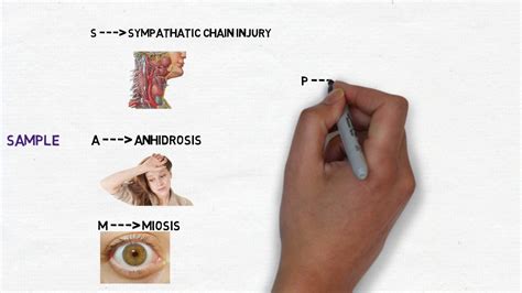Horner S Syndrome Components Mnemonic Youtube