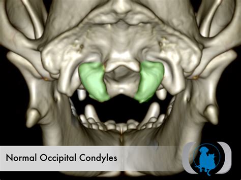 51989 Normal Occipital Condyles Caudal View Advanced Veterinary