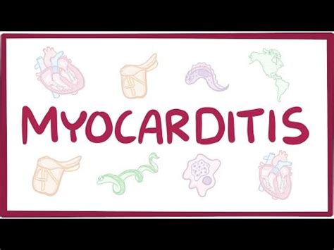 Current state of knowledge on aetiology, diagnosis, management and therapy of myocarditis. Myocarditis - causes, symptoms, diagnosis, treatment ...