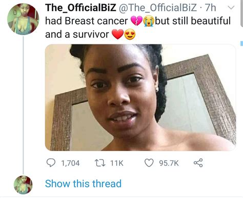 Breast Cancer Survivor Shares Topless Photo After Undergoing Double Mastectomy As She Advices Women