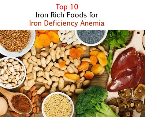 Top 10 Iron Rich Foods For Iron Deficiency Anemia Nutrition Inside