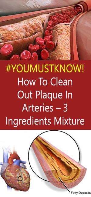 how to clean out plaque in arteries 3 ingredients mixture coconut
