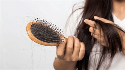 Top Image Hair Loss After Pregnancy Thptnganamst Edu Vn