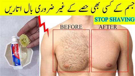 Stop Shaving How To Remove Body Hair Permanently Remove Hair