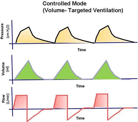 Mechanical Ventilation Types Indications Complications Settings And Modes