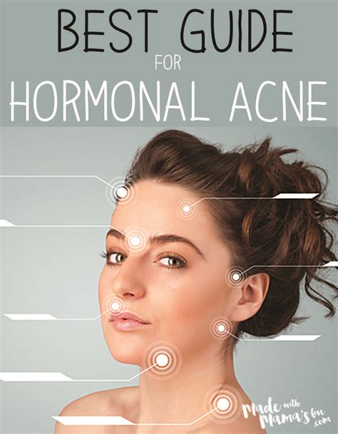 Treating Hormonal Acne Hormonal Acne Acne Treatment Hormonal Acne