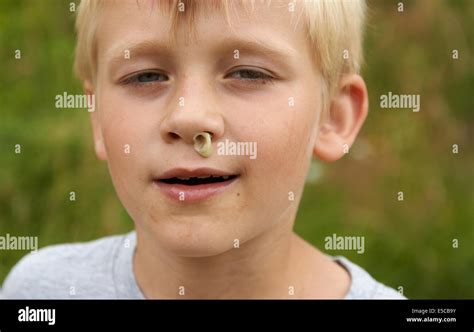 Child Blond Boy With Rhinitis Without Tissue Flowing From The Nose