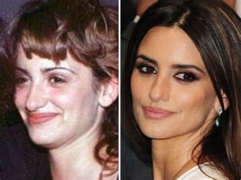 Celebrities Plastic Surgery Before And After Inspiring Your Life
