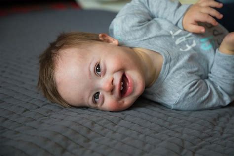 Síndrome De Down Bebé Con Síndrome De Down Síndrome De Down Trisomía 21