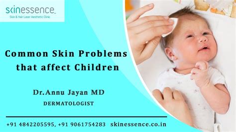 Best Skin Care Clinic In Kochi Common Skin Problems In Children L Dr